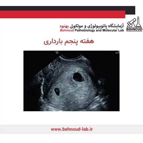 جنین دو قلو در سونوگرافی
