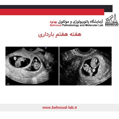 جنین دو قلو در سونوگرافی 