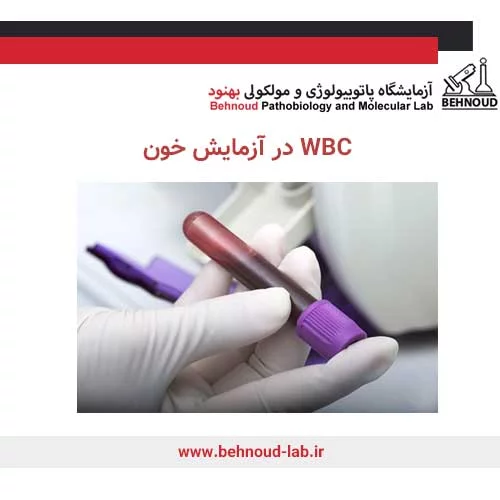 نمونه برای آزمایش WBC