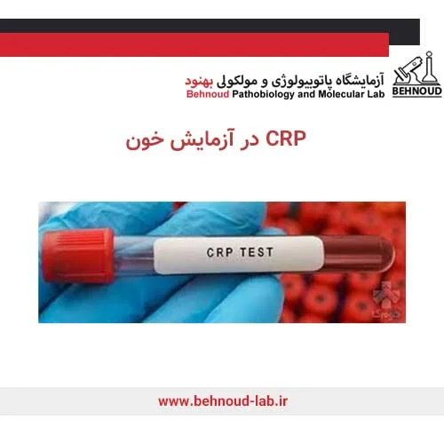 نمونه CRP