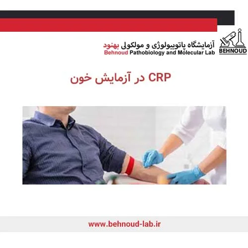 نمونه گیری خون