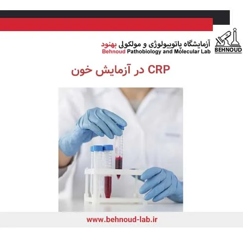 آزمایش خون