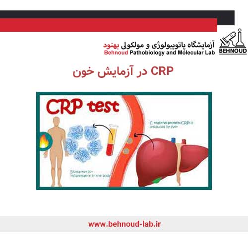 CRP در آزمایش خون