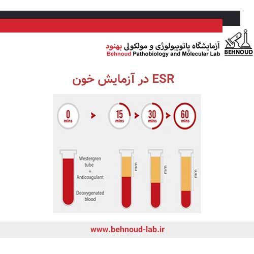 ESR در آزمایش خون