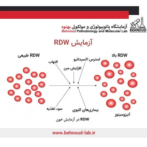 آزمایش RDW