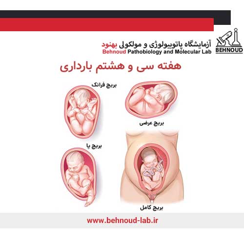 وضعیت جنین هنگام تولد
