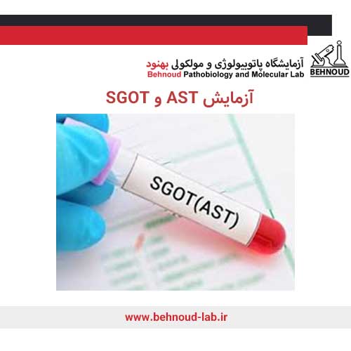 آزمایش AST یا SGOT